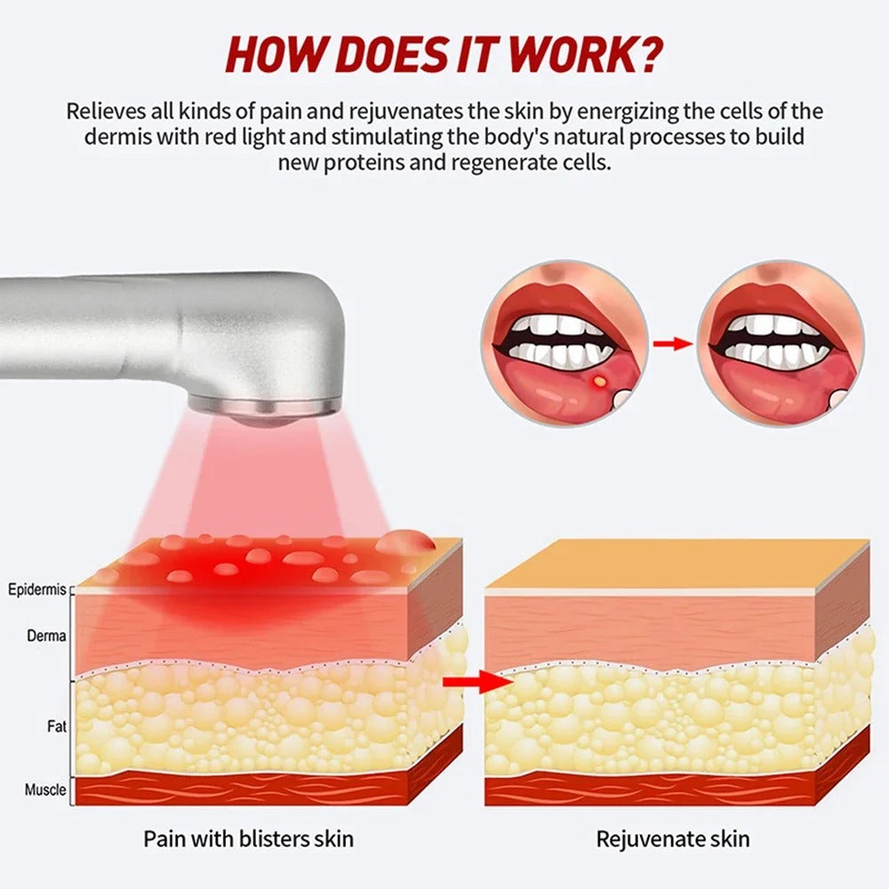 Red Light Therapy Cold Sore Device For Mouth Sores Treatment 660nm 850nm NearInfrared LED Light Therapy Machine Skin Care Wand